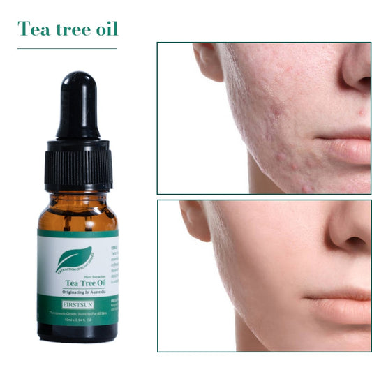 Acne Treatment Tea Oil
